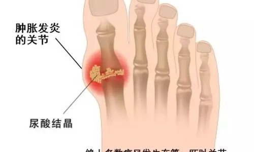糖尿病人一天喝几袋牛奶-糖尿病人一天吃很多网 | 糖尿病人一天能吃几个蛋,糖尿病人一天能吃多少苹果